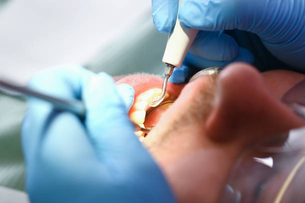 Best Emergency Gum Treatment in Oronoque, CT
